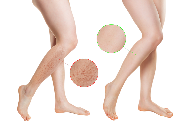 Screenshot 2023-07-07 at 07-47-49 «СЕКРЕТЫ ЗДОРОВЫХ ВЕН».png